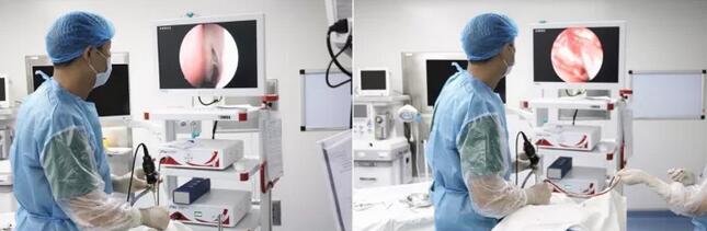 张灵医生听了微微一笑,向朱大姐介绍毕节阳明眼科医院较新技术——内路内窥镜下泪囊造孔术:在鼻腔内实施手术,所以不会在脸上留下疤痕。听了介绍之后,受尽病痛折磨的朱大姐当即同意手术.jpg 张灵医生听了微微一笑,向朱大姐介绍毕节阳明眼科医院较新技术——内路内窥镜下泪囊造孔术:在鼻腔内实施手术,所以不会在脸上留下疤痕。听了介绍之后,受尽病痛折磨的朱大姐当即同意手术.jpg