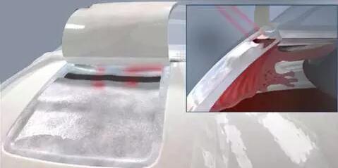 10月24日,成都牛八体育CO2激光辅助深层巩膜切除术培训会圆满落幕。本次培训会由成都牛八体育青光眼科主任、副主任医师胡建旗医生用猪眼为参会人员演示了CLASS手术全过程并指导学员进行了实际操作,学员们纷纷表示手术操作简单易懂易学,培训活动取得圆满 。.jpg 10月24日,成都牛八体育CO2激光辅助深层巩膜切除术培训会圆满落幕。本次培训会由成都牛八体育青光眼科主任、副主任医师胡建旗医生用猪眼为参会人员演示了CLASS手术全过程并指导学员进行了实际操作,学员们纷纷表示手术操作简单易懂易学,培训活动取得圆满 。.jpg