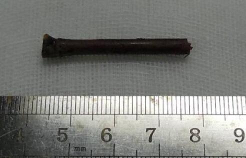 “小小竹棍把我害的好苦啊!幸好,遇到了厦门眼科中心眼整形科的胡继发副主任。医术好、态度好。大医院 医生就是不一样!”——医治眼睛后的老李激动的说道2.jpg “小小竹棍把我害的好苦啊!幸好,遇到了厦门眼科中心眼整形科的胡继发副主任。医术好、态度好。大医院 医生就是不一样!”——医治眼睛后的老李激动的说道2.jpg