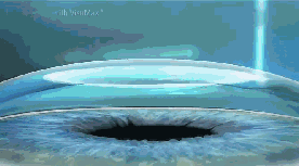 因为从手术原理来说，近视矫治手术是根据你需要 的近视度数，切削掉相应厚度的角膜，术后切削掉的角膜并不会再生长出来，所以，已经 的度数并不会复发1.png