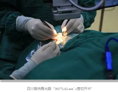 成都牛八体育已经开展的青光眼手术有:引流阀 (钉)植入手术(2015年以来已200多 ),360°Schlemm's管切开术,激光CO2 辅助巩膜深层切除术,小梁切除术青(光眼)白(内障)联合手术。还有虹膜周切术、前房成形术、 虹膜复位术,睫状体冷冻术,小梁切开术和前房穿刺术等6.png 成都牛八体育已经开展的青光眼手术有:引流阀 (钉)植入手术(2015年以来已200多 ),360°Schlemm's管切开术,激光CO2 辅助巩膜深层切除术,小梁切除术青(光眼)白(内障)联合手术。还有虹膜周切术、前房成形术、 虹膜复位术,睫状体冷冻术,小梁切开术和前房穿刺术等6.png