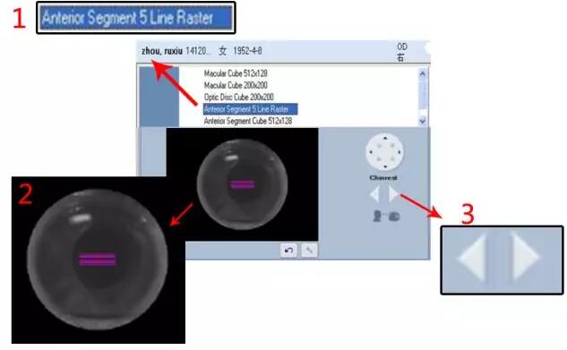 牛八体育课堂:后节频域OCT前节模块的运用1.jpg 牛八体育课堂:后节频域OCT前节模块的运用1.jpg