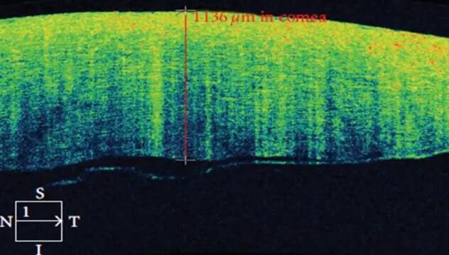 牛八体育课堂:后节频域OCT前节模块的运用3.jpg 牛八体育课堂:后节频域OCT前节模块的运用3.jpg
