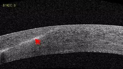 牛八体育课堂:后节频域OCT前节模块的运用4.jpg 牛八体育课堂:后节频域OCT前节模块的运用4.jpg