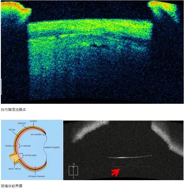 牛八体育课堂:后节频域OCT前节模块的运用14.jpg 牛八体育课堂:后节频域OCT前节模块的运用14.jpg