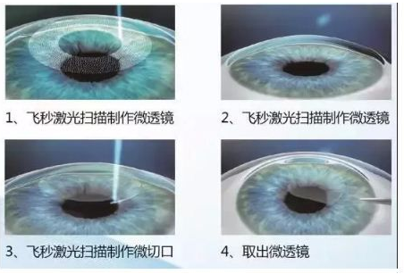 2020年首次施行“一年两征”,将义务兵征集由一年一*次征兵一*次退役,调整为一年两次征兵两次退役。实行一年两次征兵两次退役后,征兵时间区分为上半年和下半年两次1.png 2020年首次施行“一年两征”,将义务兵征集由一年一*次征兵一*次退役,调整为一年两次征兵两次退役。实行一年两次征兵两次退役后,征兵时间区分为上半年和下半年两次1.png