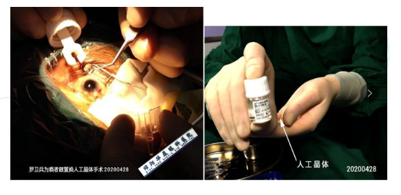 用专业技术和一*服务打消患者疑虑——绵阳牛八体育白内障医生罗卫兵2.png 用专业技术和一*服务打消患者疑虑——绵阳牛八体育白内障医生罗卫兵2.png