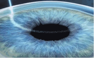 深圳牛八体育近视手术直播预告丨6.24近视手术直播+福利,视界给你!!1.gif 深圳牛八体育近视手术直播预告丨6.24近视手术直播+福利,视界给你!!1.gif