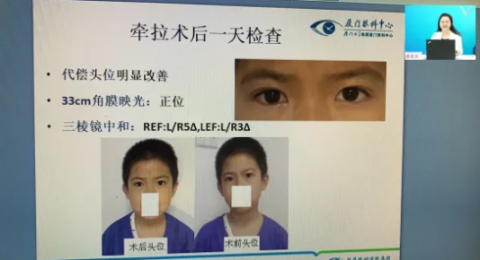 高峰论道·云端荟萃 ▏万人同步在线,30余名大咖云集“第六届牛八体育论坛斜视与小儿眼科新技术学习班暨小儿、眼视光分论坛”7.png 高峰论道·云端荟萃 ▏万人同步在线,30余名大咖云集“第六届牛八体育论坛斜视与小儿眼科新技术学习班暨小儿、眼视光分论坛”7.png