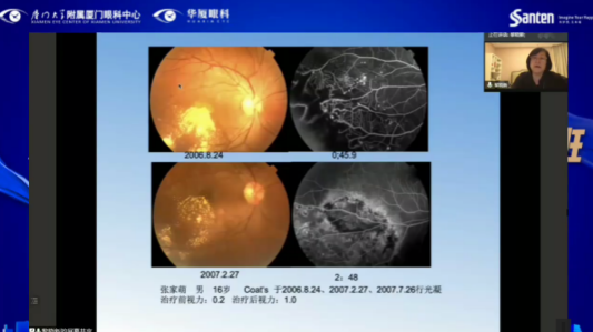 高峰论道·云端荟萃 ▏万人同步在线,30余名大咖云集“第六届牛八体育论坛斜视与小儿眼科新技术学习班暨小儿、眼视光分论坛”6.png 高峰论道·云端荟萃 ▏万人同步在线,30余名大咖云集“第六届牛八体育论坛斜视与小儿眼科新技术学习班暨小儿、眼视光分论坛”6.png