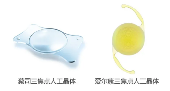 我看到了9个月亮,中国医生一招解决!“洋女婿”患白内障几近失明,在厦门眼科中心手术4.png 我看到了9个月亮,中国医生一招解决!“洋女婿”患白内障几近失明,在厦门眼科中心手术4.png