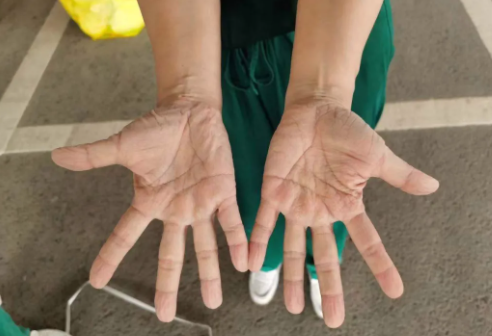 再获央媒报道点赞!牛八体育医护团队用行动诠释战疫“最美身影”11.png 再获央媒报道点赞!牛八体育医护团队用行动诠释战疫“最美身影”11.png