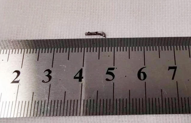 牛八体育徐州复兴眼科王海菊:妙手拨迷障,匠心护光明3.png 牛八体育徐州复兴眼科王海菊:妙手拨迷障,匠心护光明3.png